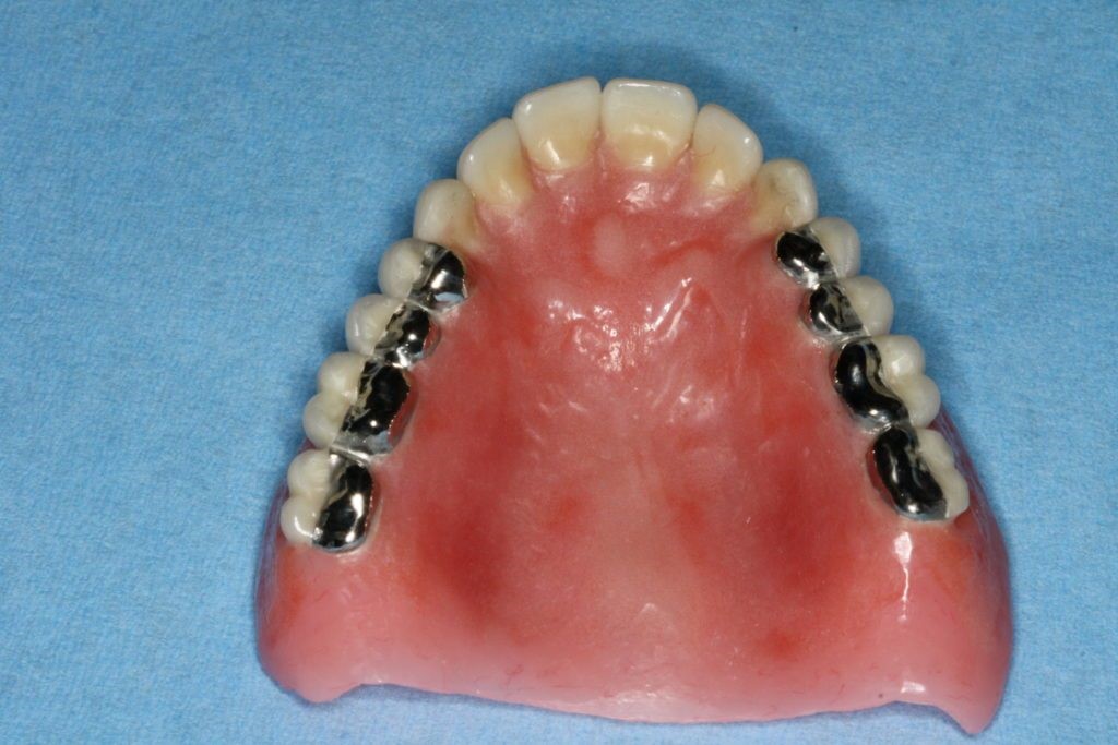 Cleaning Partial Dentures Mc Kinney TX 75069